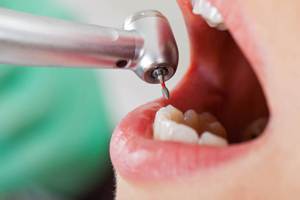 Best Emergency Dental Care for Abscessed Tooth in Vinita, OK